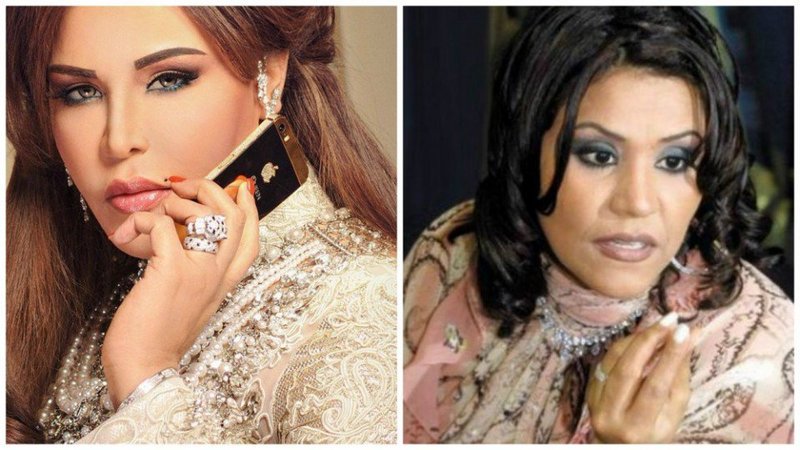 صور صادمة لأولى نجمات الخليج اللواتي قمن بعمليات تجميل الأنف (قبل وبعد)..الصورة 7 صادمة حقاً